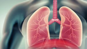 Lung transplants may save some cancer patients